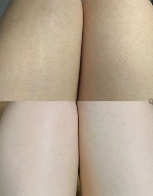 RRYN素影身体乳锁水修复是冬季肌肤本命AG真人网页身体乳哪个牌子的好用?SU(图12) RRYN素影身体乳锁水修复是冬季肌肤本命AG真人网页身体乳哪个牌子的好用?SU(图12)